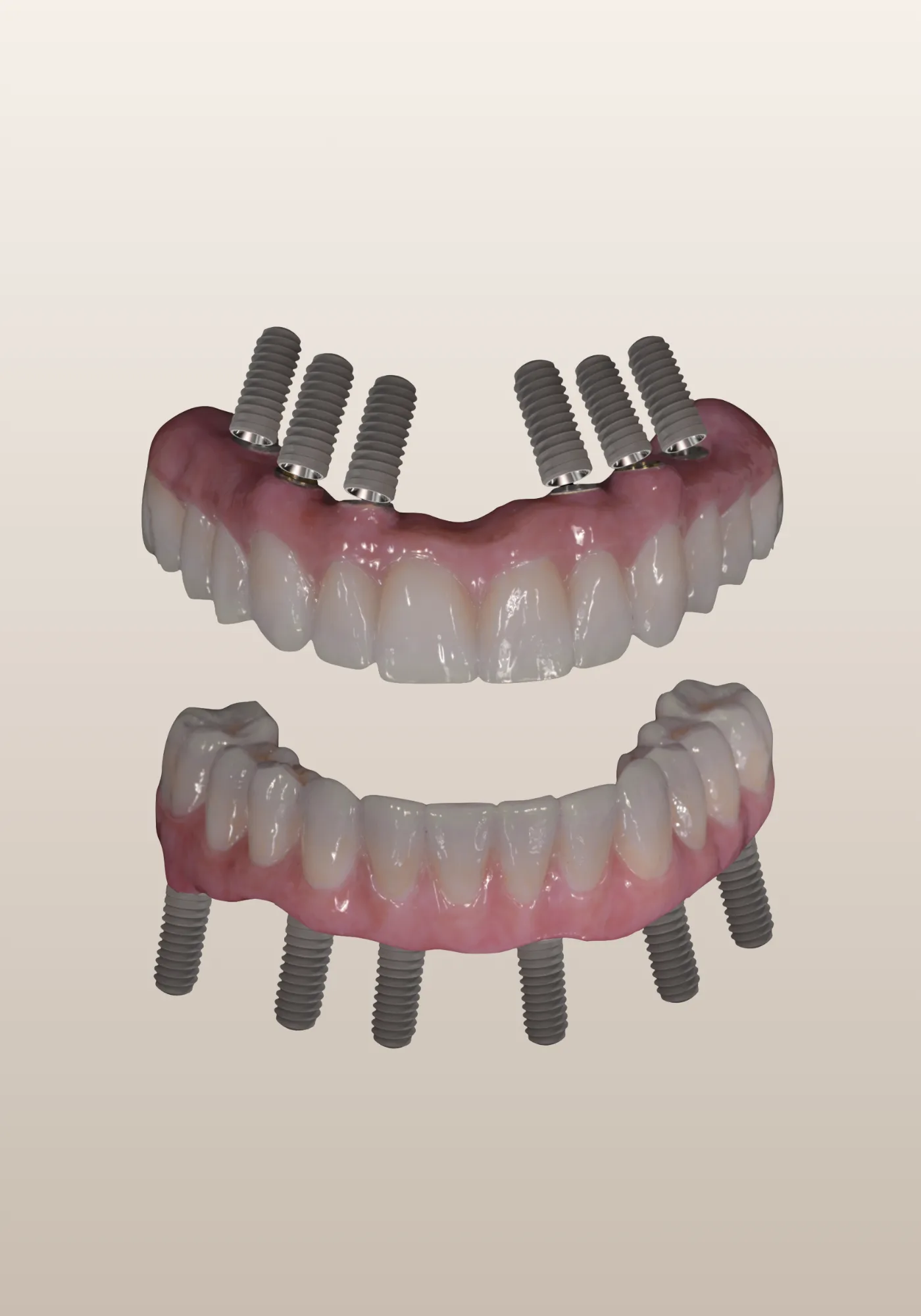 Prosthodontics in the Upper East Side, New York – Uptown Dentistry